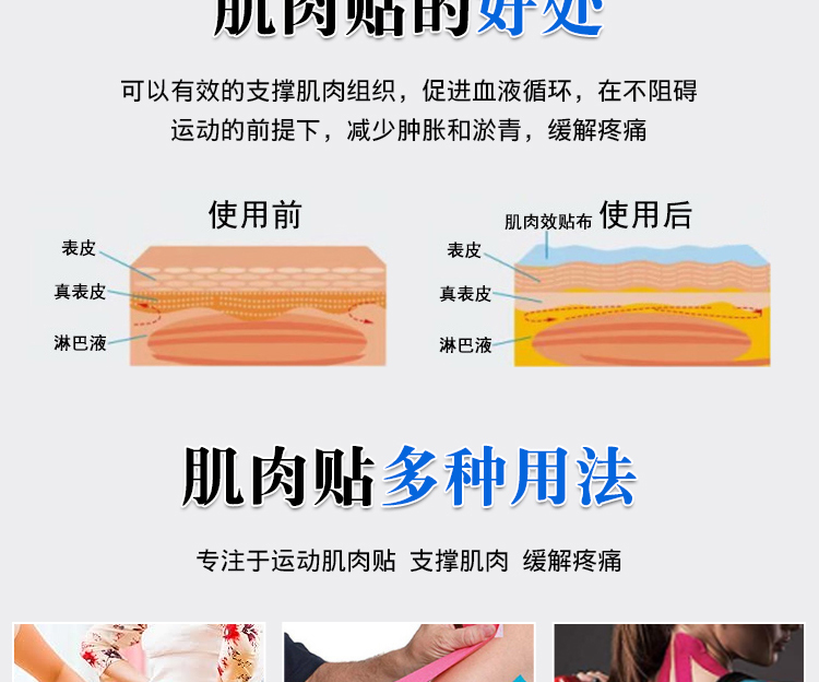 肌肉貼